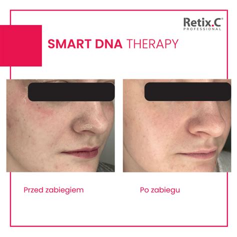 Retix C Smart Dna Therapy Lifemedica