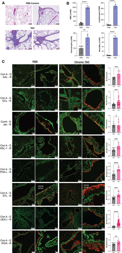 Frontiers Acute And Chronic Lung Inflammation Drives Changes In