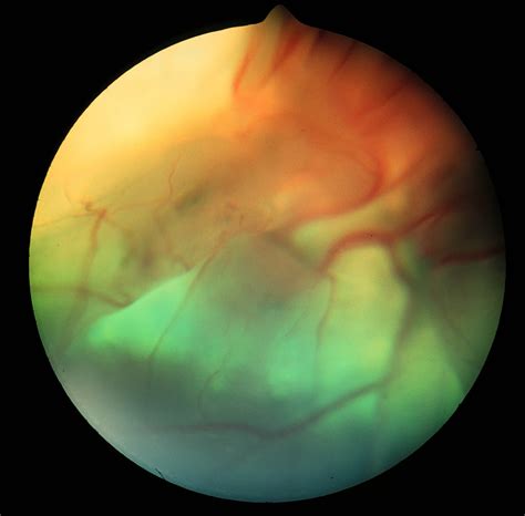 Taco Belle Times: "Tails" of a Baby Boomer Veterinarian: RETINAL