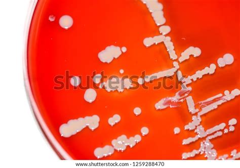 White Bacteria Beta Hemolysis Colonies On Stock Photo 1259288470 ...