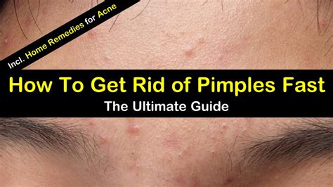 How To Reduce Zits Phaseisland17