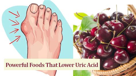 Powerful Foods That Lower Uric Acid Naturally