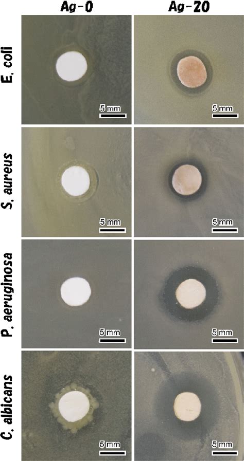 Typical Photographs Showing The Zois Around Ocp Without Ag Ag And