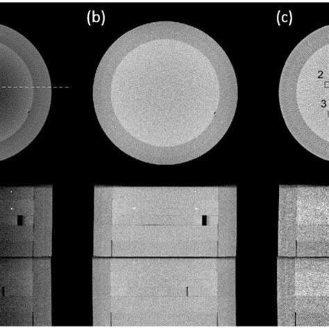 Axial Coronal And Sagittal Views Of CBCT Images On The Catphan600