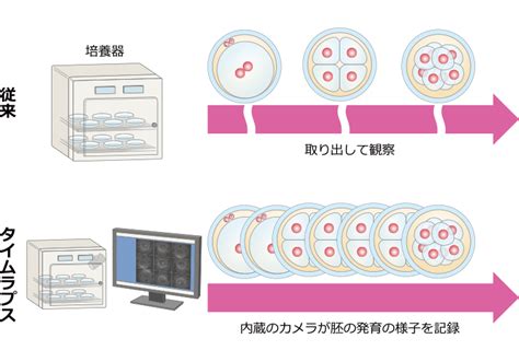 タイムラプスを行って胚を育てる先進医療とは 市原市五井の不妊子宝鍼灸整体温鍼灸ゆりかご