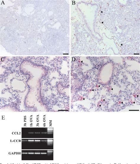 Figure From Localization And Enhanced Mrna Expression Of The Orphan