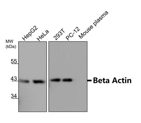 Beta Actin antibody (IR2-7) | iReal Biotechnology, Inc.