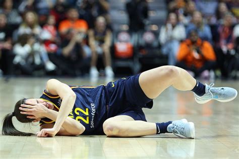 Caitlin Clark Gets A Black Eye Early In Her ‘frustrating Wnba Playoff