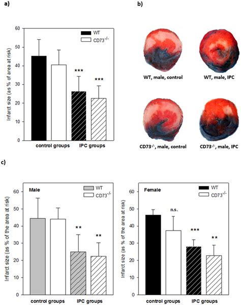 Infarct Sizes In Vivo Open Chest Model And Sex Differences A Infarct