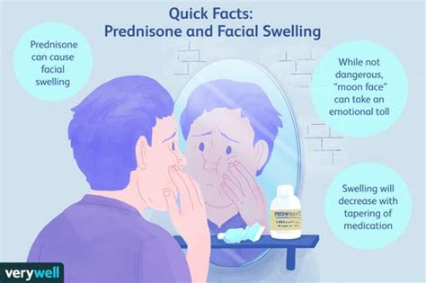 Facial Swelling Caused by Prednisone