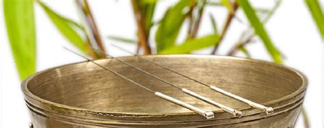 5 Reasons To Consider Trying Acupuncture Crystal Palace Osteopaths