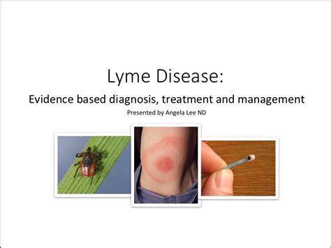 Evidence Based Diagnosis Treatment And Management For Lyme Disease