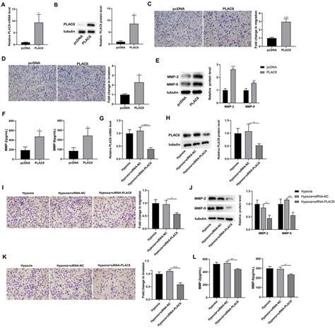 Regulation Of PLAC8 On The Migration And Invasion Of Trophoblast Cells