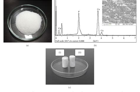 Figure 1 From Fabrication And In Vitro Evaluation Of Nanosized Hydroxyapatitechitosan Based