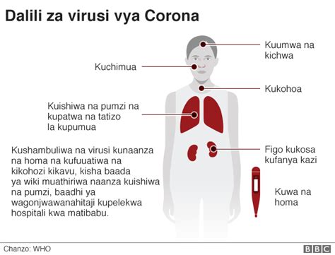 Wagonjwa Wanne Wanaoshukiwa Kuwa Na Virusi Ya Corona Wachunguzwa