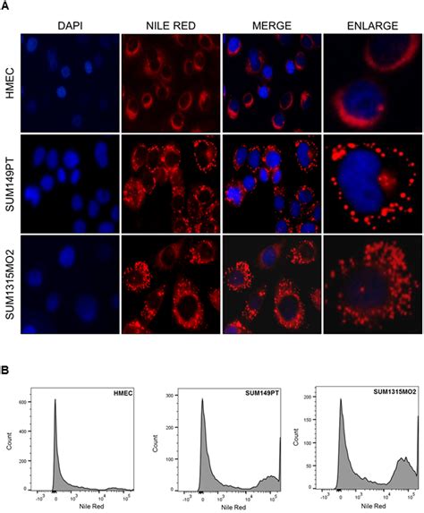 Figure 1 From Crosstalk Between Osteoprotegerin Opg Fatty Acid