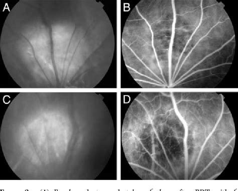 Figure 1 from BDNF reduces the retinal toxicity of verteporfin ... 