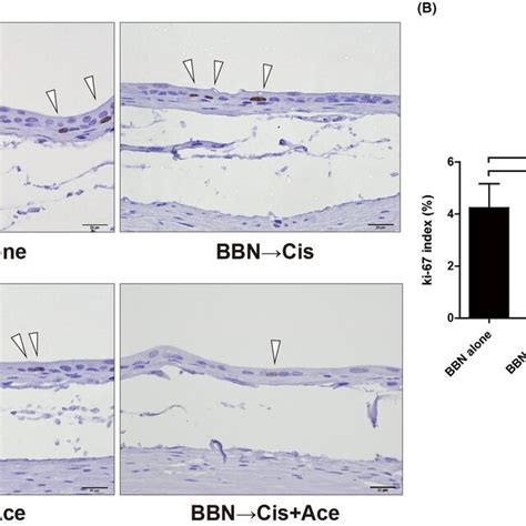 A Representative Immunohistochemical Staining Of Ki67 In