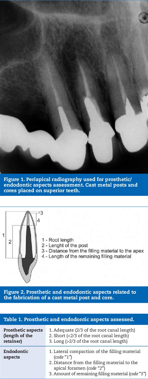 Table From Radiographic Assessment Of The Intracanal Retainer Length