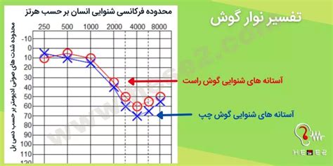 نوار گوش تفسیر نوار گوش هزینه نوار گوش 1400 حس دوم