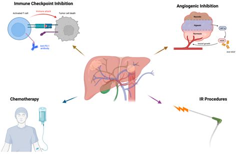 Cancers Free Full Text Potential Immunotherapy Targets For Liver Directed Therapies And The