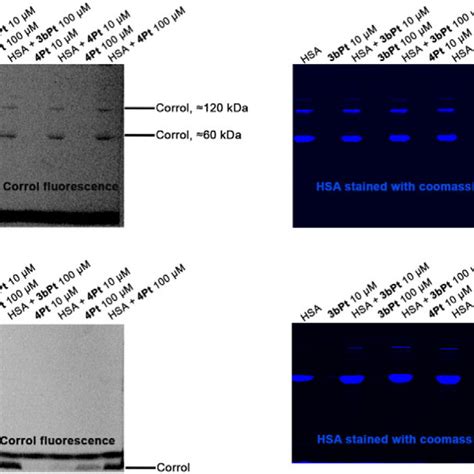 Polyacrylamide Gels Under Native A Non Denaturing Conditions And