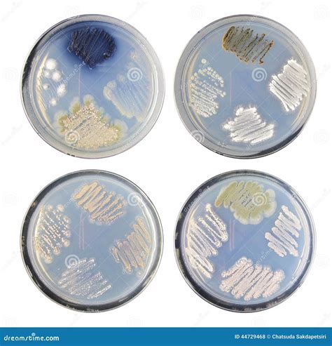 Set Of Varity Colony Bacteria (actinomycetes) Morphology On Agar Stock ...