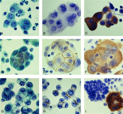 Mesothelial Cells