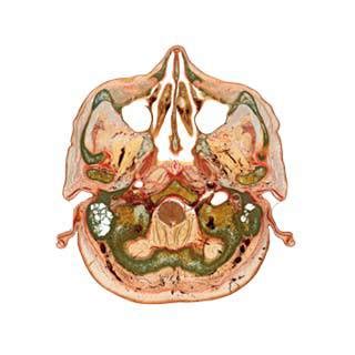 Plastinated Specimens | Real Human Specimens | Anatomic Excellence