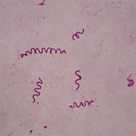 Spirillum Bacteria Under Microscope