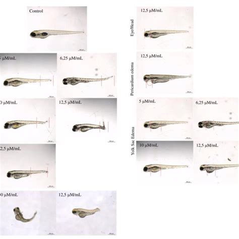 -Development of teratogenic characteristics in larvae of zebrafish 96 ...