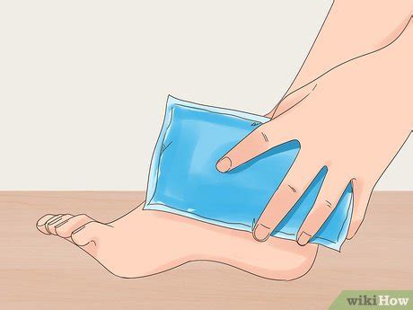 Ways To Get Rid Of Bruises Wikihow