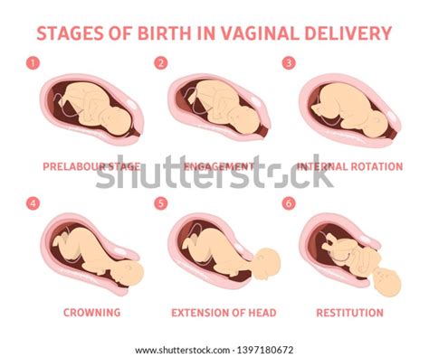 Stages Baby Birth Vaginal Delivery Fetus Stockillustratie 1397180672