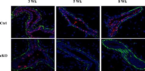 Sox9 deleted cells are lost over time. Immunostaining of control ... 