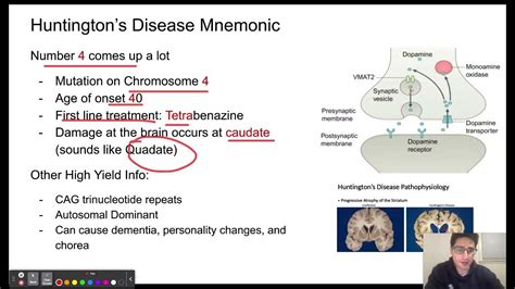 Huntingtons Disease Mnemonic Youtube