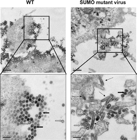 Viral Morphology As Examined By Transmission Electron Microscopy Huh7