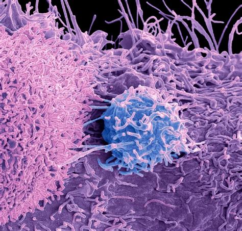 Cell Reports 前列腺癌激素治疗耐药机制发现新的有效靶点 知乎