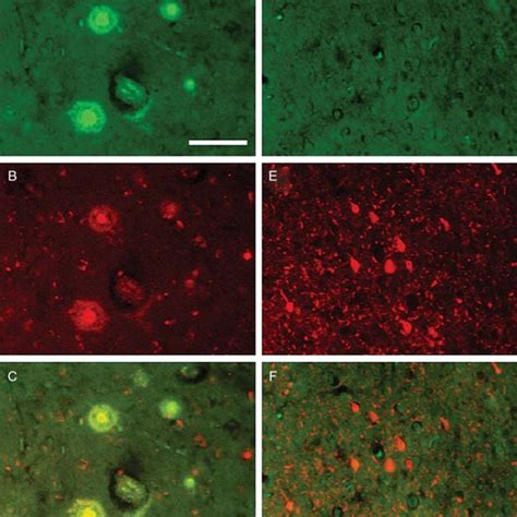 Differences In Fluorine Magnetic Resonance F Mr Signals In