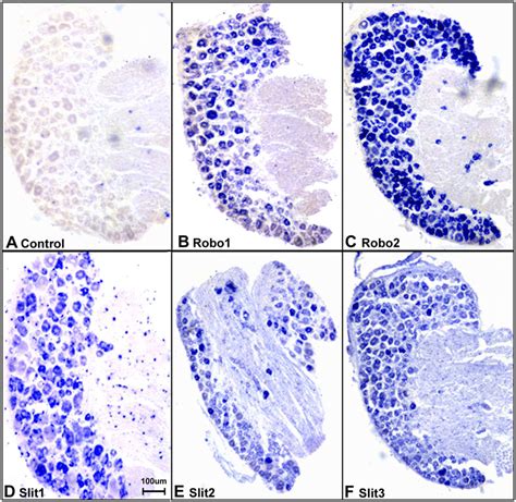 In Situ Hybridization Confirms The Expression Of Slit1 3 And Robo1 2 In