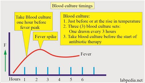 Blood Culture, its Procedure and Interpretations - Labpedia.net