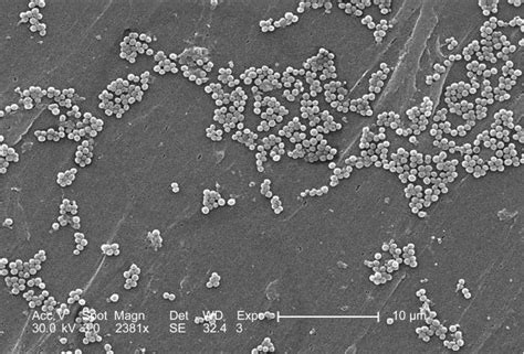 Public Domain Picture This 2005 Scanning Electron Micrograph Sem