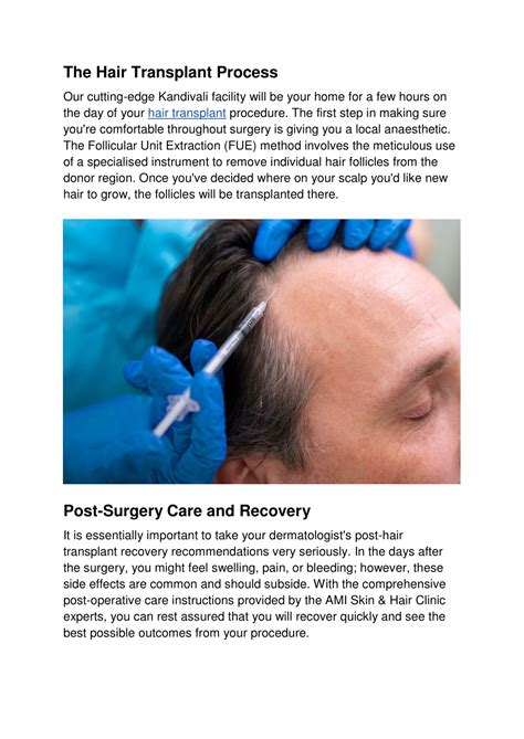 Ppt Hair Transplant Surgery What To Expect Before During And After The Procedure Powerpoint