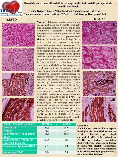 Postere Zilele Cardiologice Prof Dr George I M Georgescu