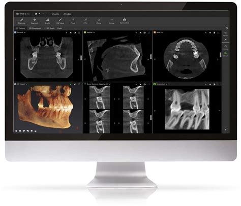 Cone Beam CT Imaging Technology Inspire Dental Wellness