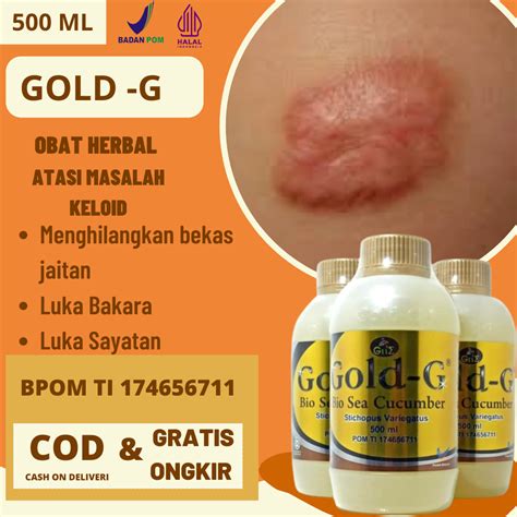 Jual Terampuh Obat Keloid Obat Penghilang Bekas Luka Secara