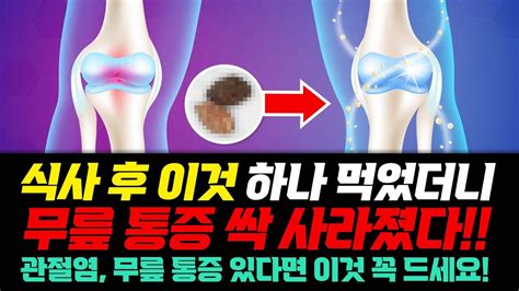 지긋지긋한 무릎 통증 관절염 식사 후 이것부터 드셔보세요 통증이 싹 사라집니다 관절에 좋은 영양제 Youtube