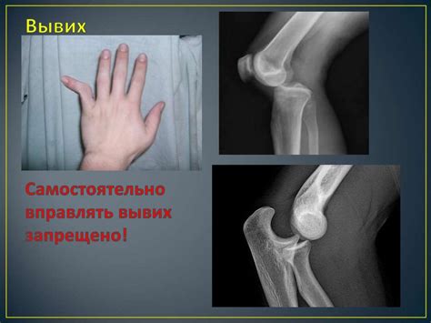 Вывих рисунок (47 фото)