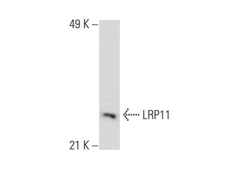 Scbt Santa Cruz Biotechnology