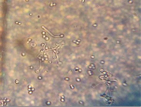 Germ Tube Of C Albicans Grown On Human Serum At 37°c For 2hrs And Half Download Scientific