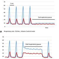 When Could Airway Plateau Pressure is Acceptable in ARDS Patients? – Critical Care News | News ...